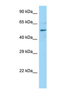 DCTN4 / Dynactin 4 Antibody - DCTN4 antibody Western blot of Mouse Heart lysate. Antibody concentration 1 ug/ml.  This image was taken for the unconjugated form of this product. Other forms have not been tested.
