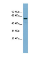 DCTN4 / Dynactin 4 Antibody - DCTN4 antibody Western blot of Fetal Muscle lysate. This image was taken for the unconjugated form of this product. Other forms have not been tested.