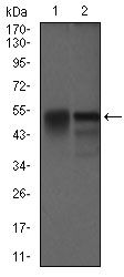 DCTN4 / Dynactin 4 Antibody - Dynactin 4 Antibody in Western Blot (WB)