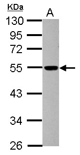 DCTN4 / Dynactin 4 Antibody - Sample (30 ug of whole cell lysate) A: SK-N-SH 10% SDS PAGE DCTN4 antibody diluted at 1:1000
