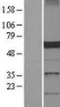 DCTN4 / Dynactin 4 Protein - Western validation with an anti-DDK antibody * L: Control HEK293 lysate R: Over-expression lysate