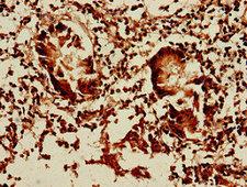DCTN5 / Dynactin 5 Antibody - Immunohistochemistry of paraffin-embedded human appendix tissue using DCTN5 Antibody at dilution of 1:100