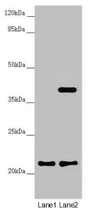 DCTN6 / Dynactin 6 Antibody - Western blot All Lanes:DCTN6 antibody at 3.5 ug/ml Lane 1: A549 whole cell lysate Lane 2: U251 whole cell lysate Secondary Goat polyclonal to rabbit IgG at 1/10000 dilution Predicted band size: 21 kDa Observed band size: 21,40 kDa