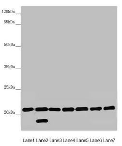 DCTN6 / Dynactin 6 Antibody - Western blot All Lanes:DCTN6 antibody at 3.03 ug/ml Lane 1: Mouse lung tissue Lane 2: Mouse gonadal tissue Lane 3: A549 whole cell lysate Lane 4: U251 whole cell lysate Lane 5: Mouse thymus tissue Lane 6: Rat brain tissue Lane 7: Mouse stomach tissue Secondary Goat polyclonal to rabbit IgG at 1/10000 dilution Predicted band size: 21 kDa Observed band size: 21,18 kDa
