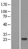 DCTN6 / Dynactin 6 Protein - Western validation with an anti-DDK antibody * L: Control HEK293 lysate R: Over-expression lysate