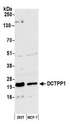 DCTPP1 / XTP3TPA Antibody - Detection of human DCTPP1 by western blot. Samples: Whole cell lysate (50 µg) from HEK293T and MCF-7 cells prepared using NETN lysis buffer. Antibody: Affinity purified rabbit anti-DCTPP1 antibody used for WB at 1:1000. Detection: Chemiluminescence with an exposure time of 3 minutes.