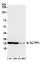 DCTPP1 / XTP3TPA Antibody - Detection of human DCTPP1 by western blot. Samples: Whole cell lysate (50 µg) from HEK293T, MCF-7, and A-549 cells prepared using NETN lysis buffer. Antibody: Affinity purified rabbit anti-DCTPP1 antibody used for WB at 1:1000. Detection: Chemiluminescence with an exposure time of 30 seconds.