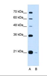 DCTPP1 / XTP3TPA Antibody - Lane A: Marker. Lane B: HepG2 cell lysate. Antibody concentration: 0.5 ug/ml. Gel concentration: 12%.  This image was taken for the unconjugated form of this product. Other forms have not been tested.