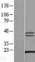 DCTPP1 / XTP3TPA Protein - Western validation with an anti-DDK antibody * L: Control HEK293 lysate R: Over-expression lysate