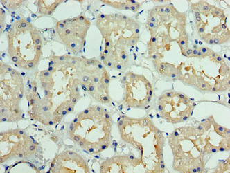DCUN1D1 / SCCRO Antibody - Immunohistochemistry of paraffin-embedded human kidney tissue using DCUN1D1 Antibody at dilution of 1:100