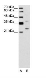 DCUN1D1 / SCCRO Antibody - A: Marker, B: Jurkat Cell Lysate.  This image was taken for the unconjugated form of this product. Other forms have not been tested.