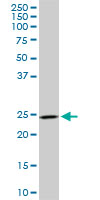 DCUN1D1 / SCCRO Antibody - DCUN1D1 monoclonal antibody (M02), clone 4B5. Western blot of DCUN1D1 expression in PC-12.