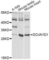 DCUN1D1 / SCCRO Antibody - Western blot analysis of extracts of various cell lines, using DCUN1D1 antibody at 1:1000 dilution. The secondary antibody used was an HRP Goat Anti-Rabbit IgG (H+L) at 1:10000 dilution. Lysates were loaded 25ug per lane and 3% nonfat dry milk in TBST was used for blocking. An ECL Kit was used for detection and the exposure time was 30s.