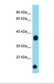 DCUN1D2 Antibody - Western blot of Mouse Heart. Dcun1d2 antibody dilution 1.0 ug/ml.  This image was taken for the unconjugated form of this product. Other forms have not been tested.