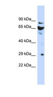 DCUN1D3 Antibody - DCUN1D3 antibody Western blot of Fetal Kidney lysate. This image was taken for the unconjugated form of this product. Other forms have not been tested.