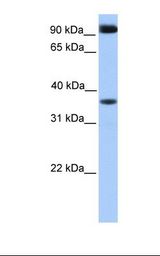 DCUN1D4 Antibody - Fetal heart lysate. Antibody concentration: 1.0 ug/ml. Gel concentration: 12%.  This image was taken for the unconjugated form of this product. Other forms have not been tested.