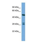 DCUN1D4 Antibody - Western blot of Human HepG2. DCUN1D4 antibody dilution 1.0 ug/ml.  This image was taken for the unconjugated form of this product. Other forms have not been tested.