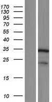 DCUN1D4 Protein - Western validation with an anti-DDK antibody * L: Control HEK293 lysate R: Over-expression lysate