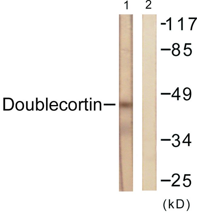 DCX / Doublecortin Antibody - Western blot analysis of lysates from RAW264.7 cells, using Doublecortin Antibody. The lane on the right is blocked with the synthesized peptide.
