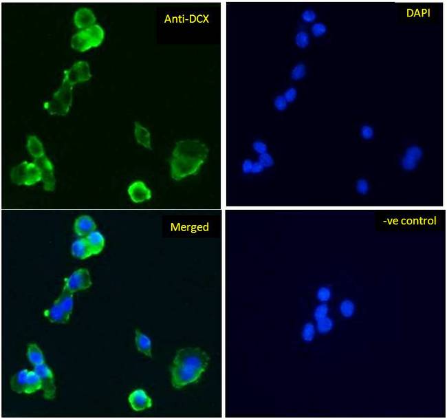 DCX / Doublecortin Antibody - DCX / Doublecortin antibody immunofluorescence analysis of paraformaldehyde fixed HepG2 cells, permeabilized with 0.15% Triton. Primary incubation 1hr (5ug/ml) followed by Alexa Fluor 488 secondary antibody (1ug/ml), showing cytoplasmic staining. The nuclear stain is DAPI (blue). Negative control: Unimmunized goat IgG (10ug/ml) followed by Alexa Fluor 488 secondary antibody (2ug/ml).