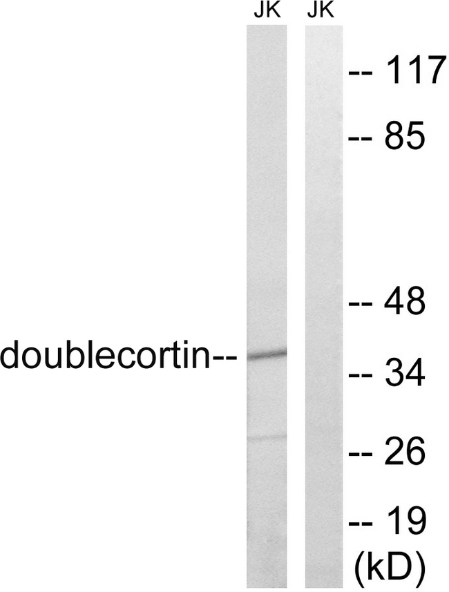 DCX / Doublecortin Antibody - Western blot analysis of lysates from Jurkat cells, using Doublecortin Antibody. The lane on the right is blocked with the synthesized peptide.