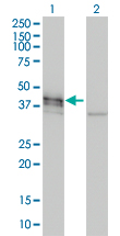 DCX / Doublecortin Antibody - Western Blot analysis of DCX expression in transfected 293T cell line by DCX monoclonal antibody (M01), clone 1G12.Lane 1: DCX transfected lysate(41.4 KDa).Lane 2: Non-transfected lysate.