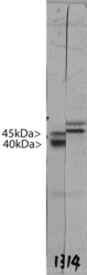 DCX / Doublecortin Antibody - Blots of crude rat brain extract from a postnatal 3 day animal stained with DCX / Doublecortin antibody. Two bands at ~45 kDa and ~35 kDa show that DCX / Doublecortin antibody binds to an epitope in the region of DCX shared by Lis-A, and Lis-B, Lis-C and Lis-D, the C terminal 360 amino acids of Lis-A.