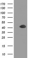 DCX / Doublecortin Antibody - HEK293T cells were transfected with the pCMV6-ENTRY control (Left lane) or pCMV6-ENTRY DCX (Right lane) cDNA for 48 hrs and lysed. Equivalent amounts of cell lysates (5 ug per lane) were separated by SDS-PAGE and immunoblotted with anti-DCX.