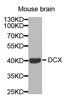 DCX / Doublecortin Antibody - Western blot analysis of extracts of mouse brain, using DCX antibody. The secondary antibody used was an HRP Goat Anti-Rabbit IgG (H+L) at 1:10000 dilution. Lysates were loaded 25ug per lane and 3% nonfat dry milk in TBST was used for blocking.