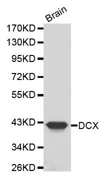 DCX / Doublecortin Antibody - Western blot analysis of extracts of mouse brain, using DCX antibody. The secondary antibody used was an HRP Goat Anti-Rabbit IgG (H+L) at 1:10000 dilution. Lysates were loaded 25ug per lane and 3% nonfat dry milk in TBST was used for blocking.