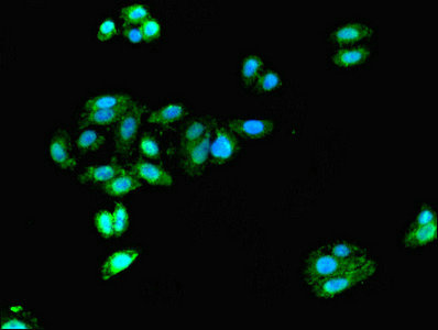 DCX / Doublecortin Antibody - Immunofluorescent analysis of HepG2 cells using DCX Antibody at dilution of 1:100 and Alexa Fluor 488-congugated AffiniPure Goat Anti-Rabbit IgG(H+L)