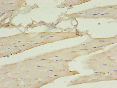 DCX / Doublecortin Antibody - Immunohistochemistry of paraffin-embedded human skeletal muscle tissue using DCX Antibody at dilution of 1:100