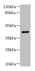DCX / Doublecortin Antibody - Western blot All lanes: DCX antibody at 8µg/ml + Mouse brain tissue Secondary Goat polyclonal to rabbit IgG at 1/10000 dilution Predicted band size: 49 kDa Observed band size: 49 kDa