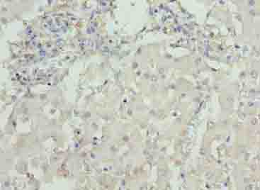 DCX / Doublecortin Antibody - Immunohistochemistry of paraffin-embedded human liver tissue using antibody at dilution of 1:100.
