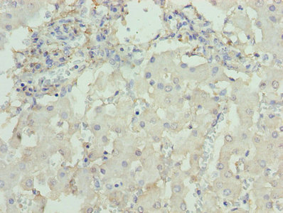 DCX / Doublecortin Antibody - Immunohistochemistry of paraffin-embedded human liver tissue using DCX Antibody at dilution of 1:100