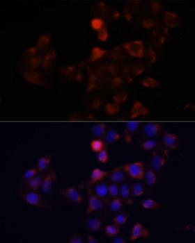 DCX / Doublecortin Antibody - Immunofluorescence analysis of HeLa cells using DCX antibody at dilution of 1:100. Blue: DAPI for nuclear staining.
