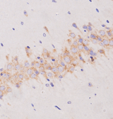 DCX / Doublecortin Antibody - 1:200 staining mouse brain tissue by IHC-P. The tissue was formaldehyde fixed and a heat mediated antigen retrieval step in citrate buffer was performed. The tissue was then blocked and incubated with the antibody for 1.5 hours at 22°C. An HRP conjugated goat anti-rabbit antibody was used as the secondary.