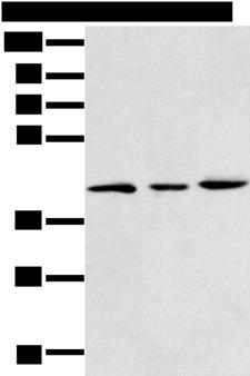 DCX / Doublecortin Antibody - Western blot analysis of 293T K562 and Raji cell  using DCX Polyclonal Antibody at dilution of 1:400