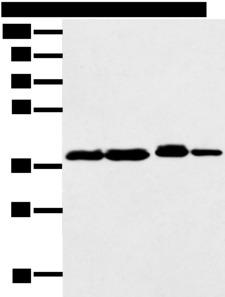 DCX / Doublecortin Antibody - Western blot analysis of 293T K562 Jurkat cell  using DCX Polyclonal Antibody at dilution of 1:500