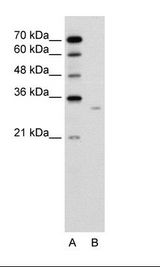 DCXR Antibody - A: Marker, B: Jurkat Cell Lysate.  This image was taken for the unconjugated form of this product. Other forms have not been tested.