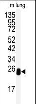 DCXR Antibody - Western blot of anti-DCXR Antibody in mouse lung tissue lysates (35 ug/lane). DCXR (arrow) was detected using the purified antibody.