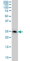 DCXR Antibody - DCXR monoclonal antibody (M03), clone 6A6 Western blot of DCXR expression in A-431.