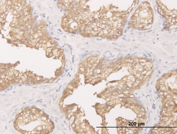 DCXR Antibody - Immunoperoxidase of monoclonal antibody to DCXR on formalin-fixed paraffin-embedded human prostate. [antibody concentration 1 ug/ml]