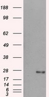 DCXR Antibody - HEK293T cells were transfected with the pCMV6-ENTRY control (Left lane) or pCMV6-ENTRY DCXR (Right lane) cDNA for 48 hrs and lysed. Equivalent amounts of cell lysates (5 ug per lane) were separated by SDS-PAGE and immunoblotted with anti-DCXR.