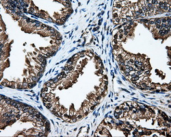 DCXR Antibody - IHC of paraffin-embedded prostate tissue using anti-DCXR mouse monoclonal antibody. (Dilution 1:50).