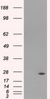 DCXR Antibody - HEK293T cells were transfected with the pCMV6-ENTRY control (Left lane) or pCMV6-ENTRY DCXR (Right lane) cDNA for 48 hrs and lysed. Equivalent amounts of cell lysates (5 ug per lane) were separated by SDS-PAGE and immunoblotted with anti-DCXR.