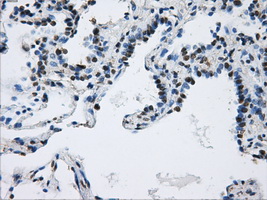 DCXR Antibody - IHC of paraffin-embedded lung tissue using anti-DCXR mouse monoclonal antibody. (Dilution 1:50).