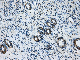 DCXR Antibody - IHC of paraffin-embedded Ovary tissue using anti-DCXR mouse monoclonal antibody. (Dilution 1:50).