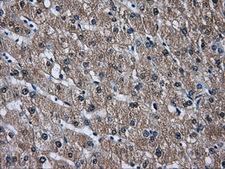 DCXR Antibody - IHC of paraffin-embedded liver tissue using anti-DCXR mouse monoclonal antibody. (Dilution 1:50).