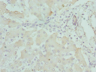 DCXR Antibody - Immunohistochemistry of paraffin-embedded human liver tissue at dilution 1:100